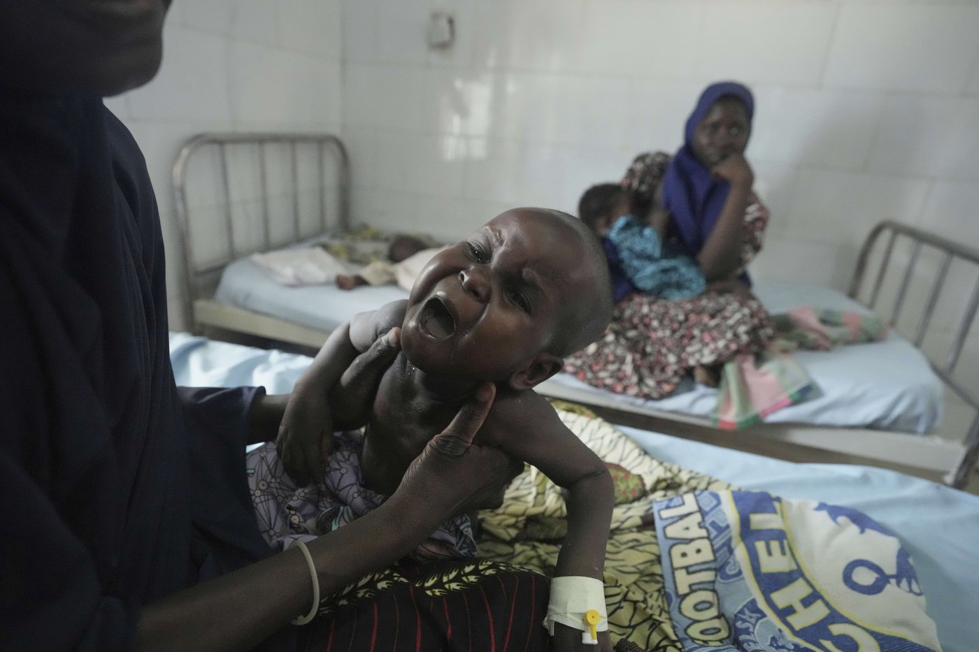 Children die as USAID aid cuts snap a lifeline for the world's most malnourished | iNFOnews.ca