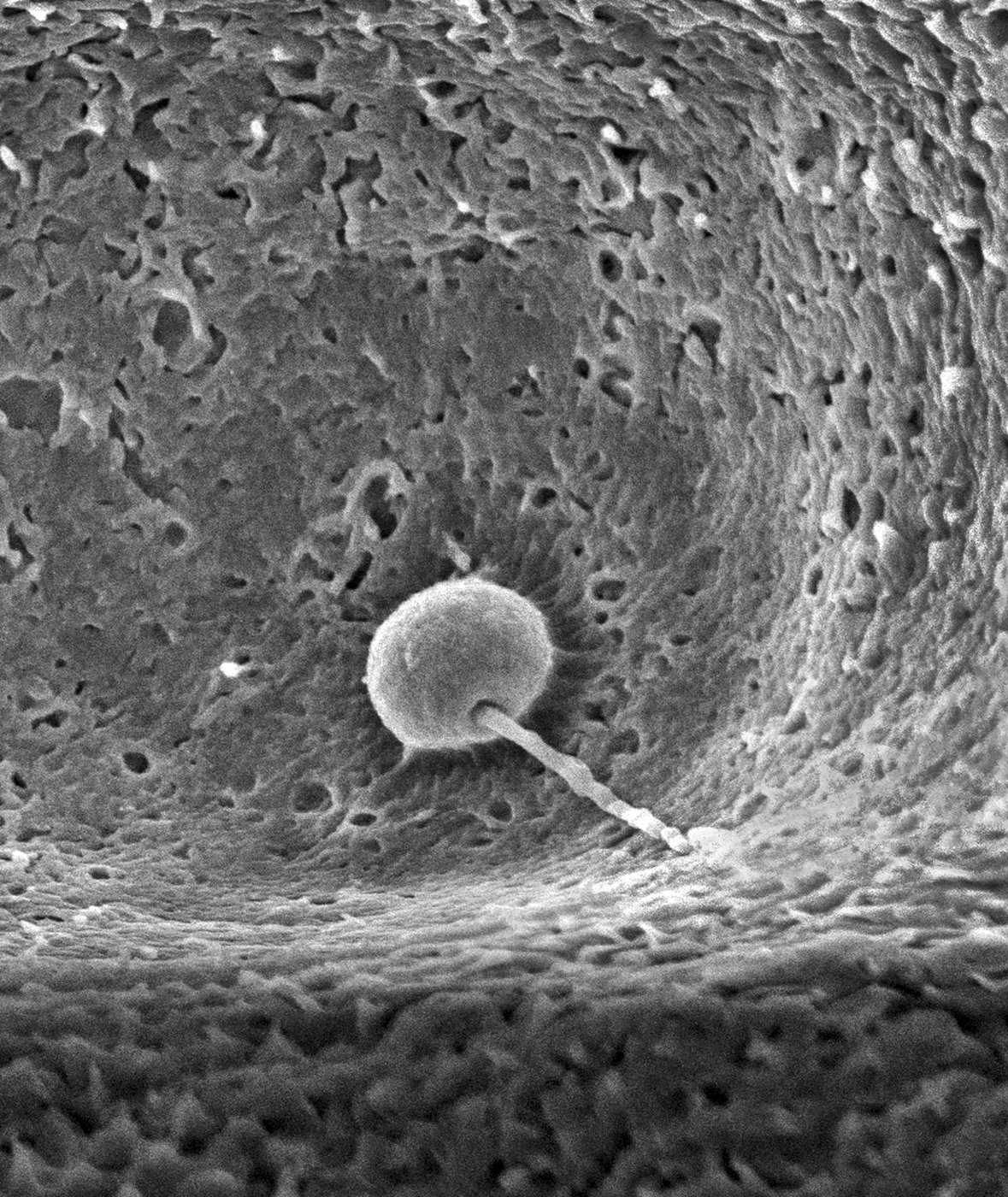 Scientists show how sperm and egg come together like a key in a lock | iNFOnews.ca Scientists show how sperm and egg come together like a key in a lock | iNFOnews.ca