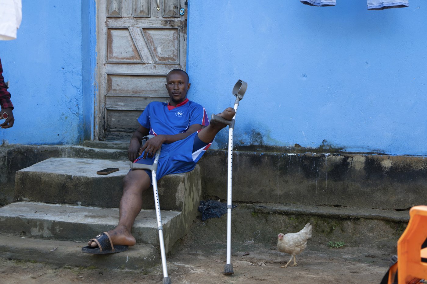 'We fall and we rise': Some amputees in Sierra Leone turn to farming to combat discrimination | iNFOnews.ca