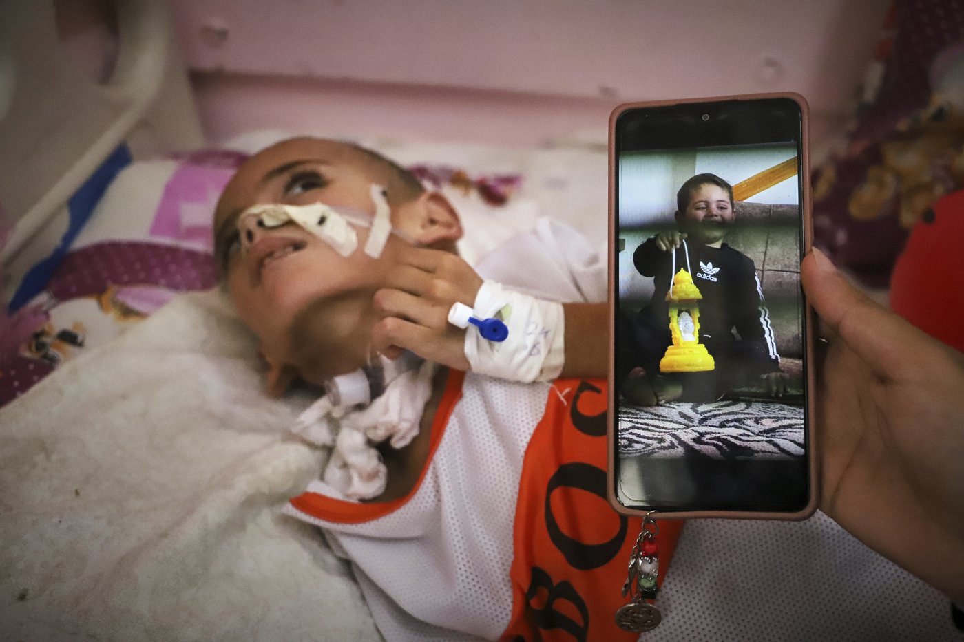 A boy with a brain injury fights for his life in Gaza's decimated health system | iNFOnews.ca