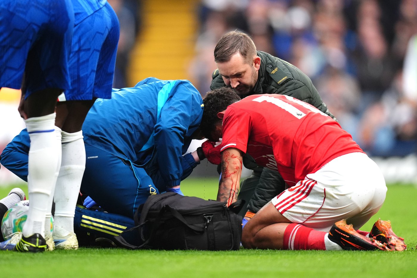 Gibbs-White might need a face mask to play for Forest in Europa League semifinals against Villa | iNFOnews.ca Gibbs-White might need a face mask to play for Forest in Europa League semifinals against Villa | iNFOnews.ca