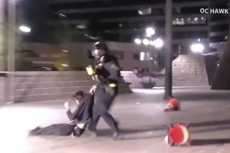 Demonstrator injured after federal agent fired projectile from close range during California protest | iNFOnews.ca