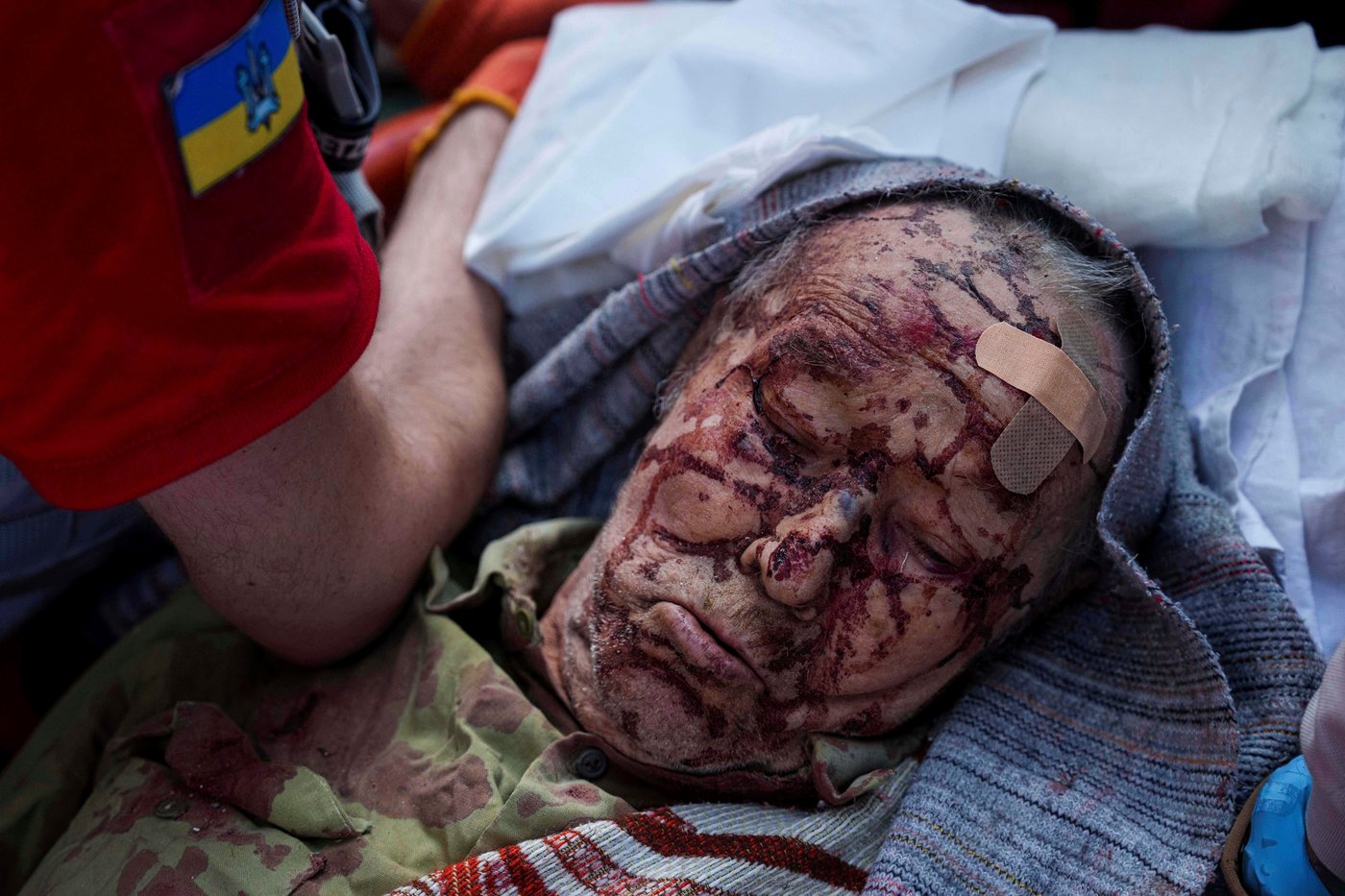 The top AP photos from Ukraine in 2025 show its grief and grit in another year of war | iNFOnews.ca