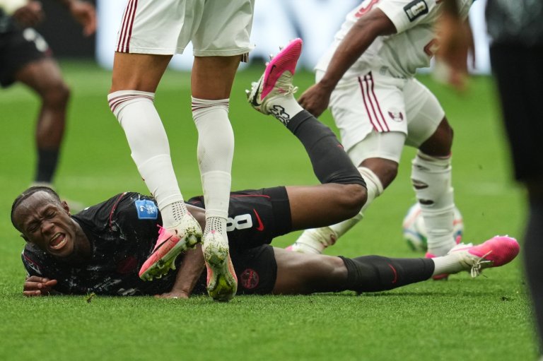 One Extraordinary Photo: Canada's Ismael Kone reacts to his injury | iNFOnews.ca