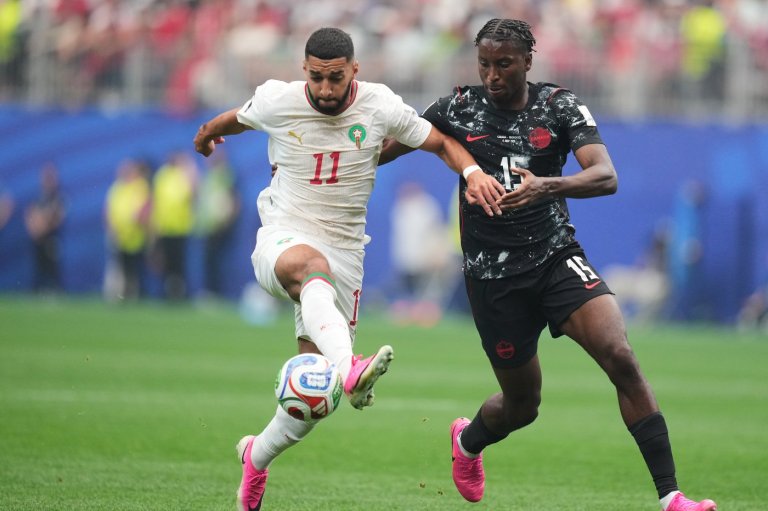 Canadian national team defender Bombito set for second surgery on left tibia | iNFOnews.ca