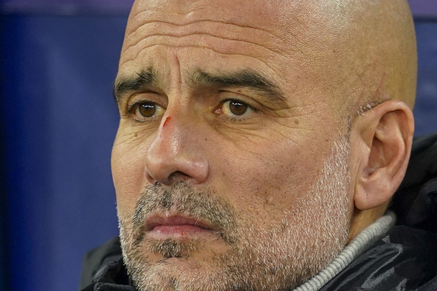 Pep Guardiola clarifies his remark about self harm made after Man City's latest bad result | iNFOnews.ca