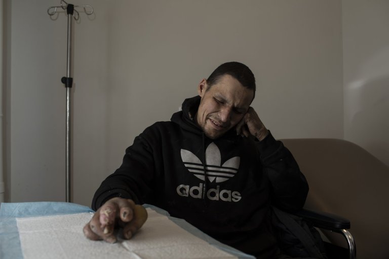 'Frostbite capital': Efforts to reduce frostbite amputations underway in Edmonton | iNFOnews.ca