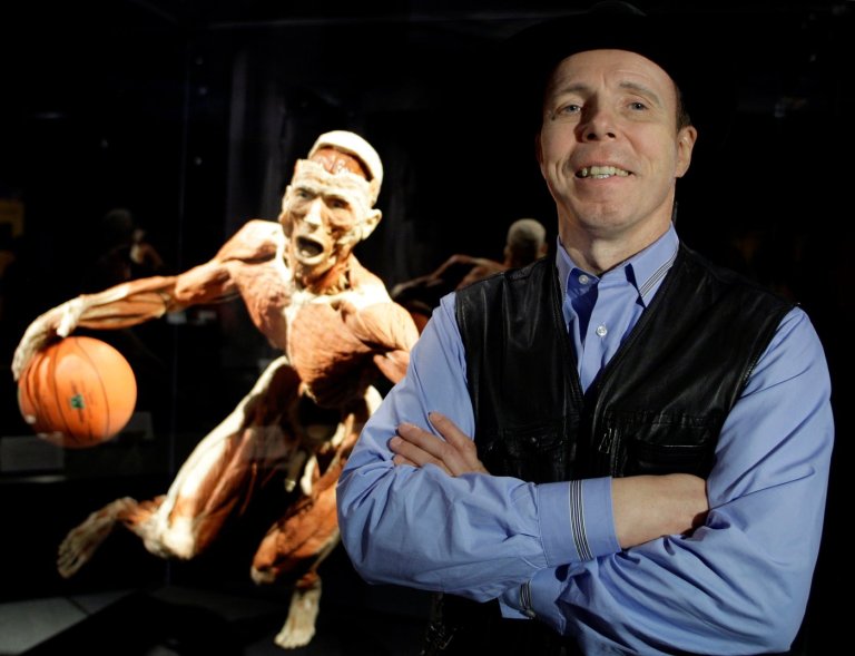 Gunther von Hagens, the German anatomist behind the 'Body Worlds' exhibition, dies at 81 | iNFOnews.ca