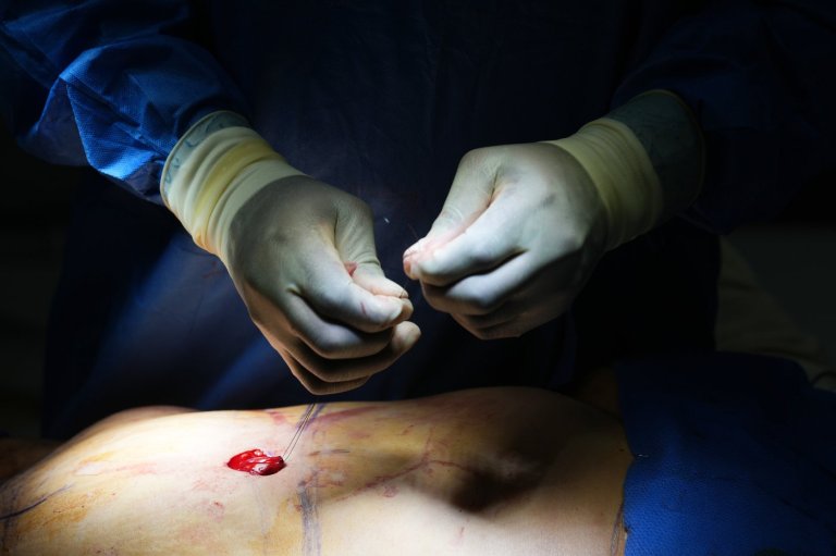Cosmetic interventions are booming. Many say ethical conversations are lagging | iNFOnews.ca