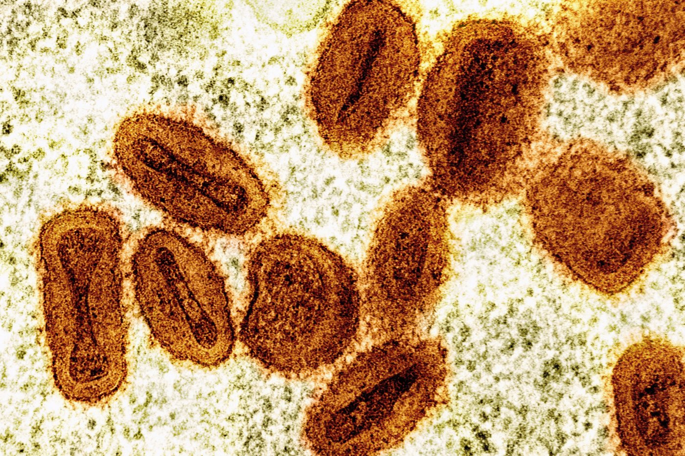 2 scientists charged with bringing deactivated mpox virus into the US and lying to authorities | iNFOnews.ca