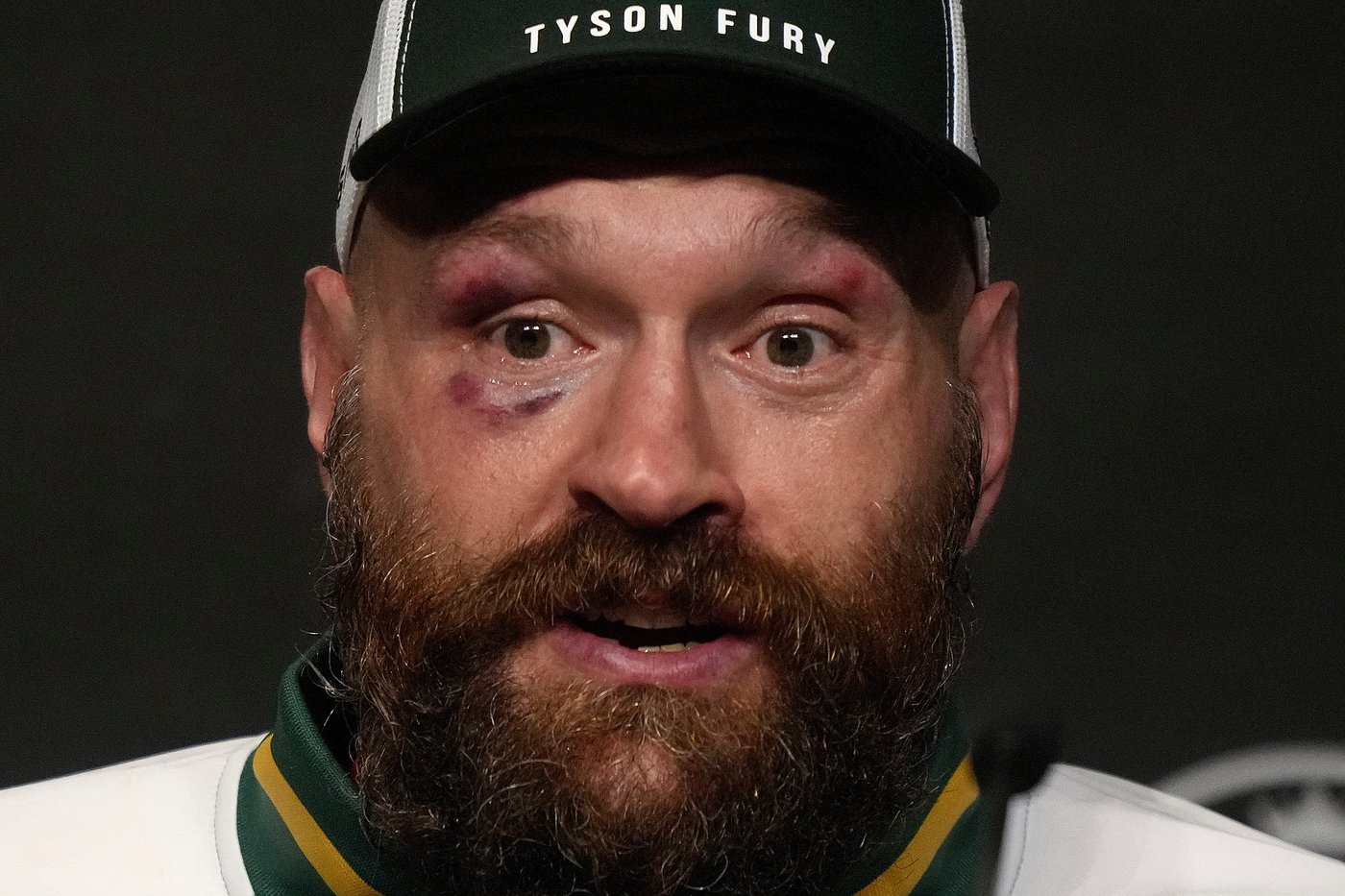 Tyson Fury faces bear-wrestling Arslanbek Makhmudov in his latest comeback to heavyweight boxing | iNFOnews.ca Tyson Fury faces bear-wrestling Arslanbek Makhmudov in his latest comeback to heavyweight boxing | iNFOnews.ca