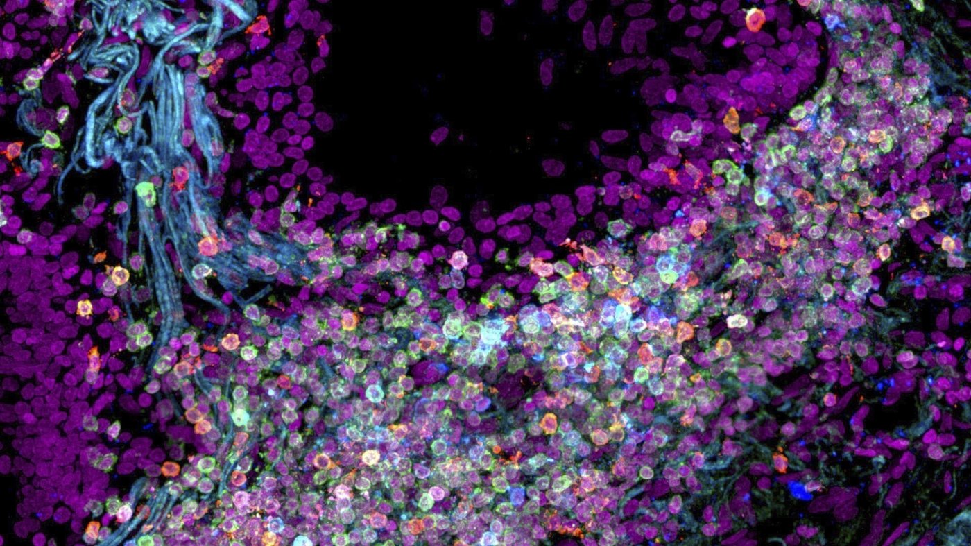 Scientists map out the human body one cell at a time | iNFOnews.ca Scientists map out the human body one cell at a time | iNFOnews.ca