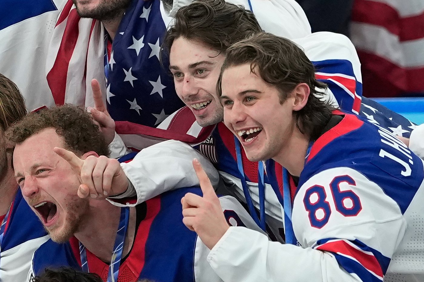 Olympic hero Jack Hughes has new chiclets as NHL dentists get a moment in the spotlight | iNFOnews.ca