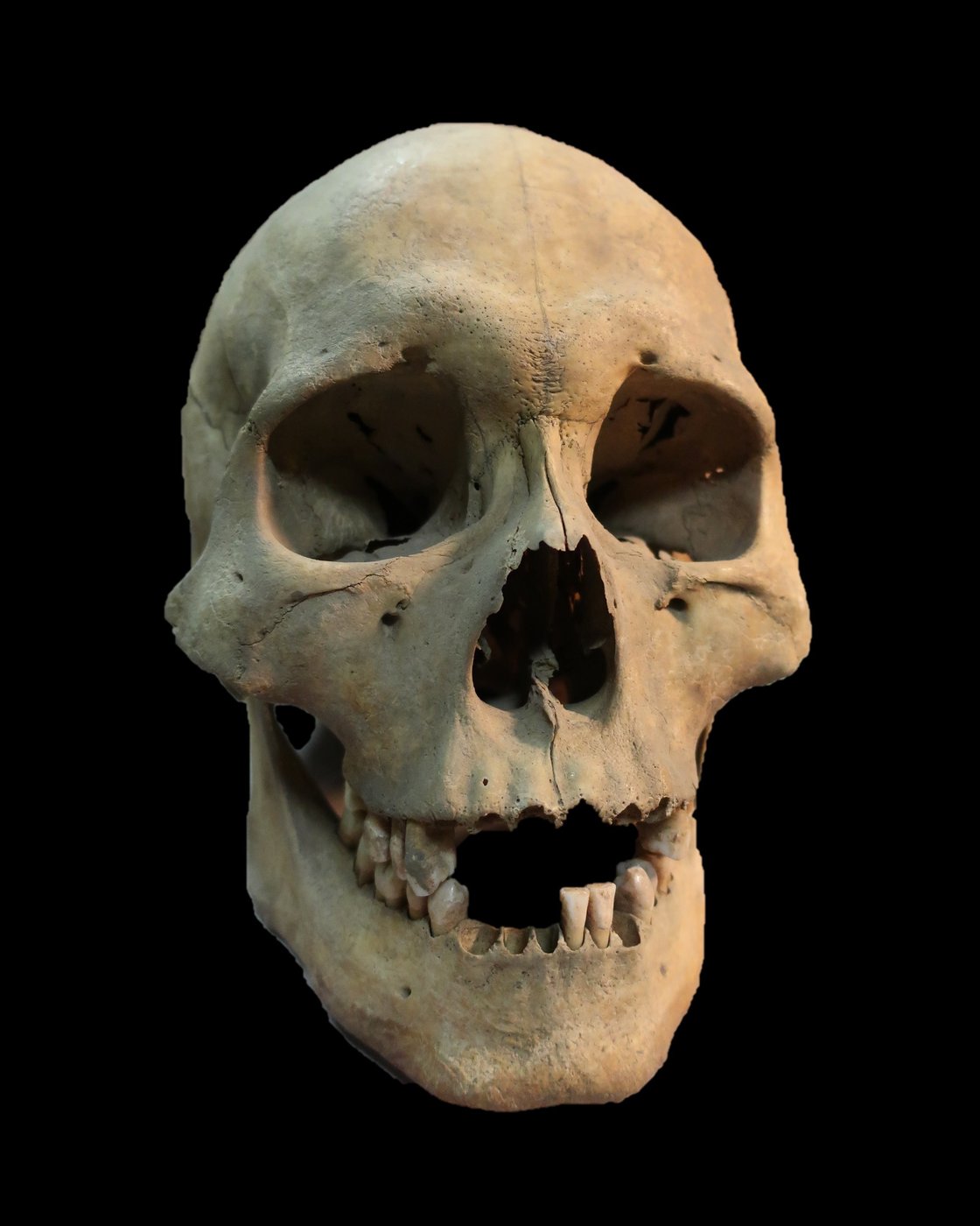 Ancient teeth from Siberia rewrite the plague’s timeline, dating back to over 5,500 years ago | iNFOnews.ca