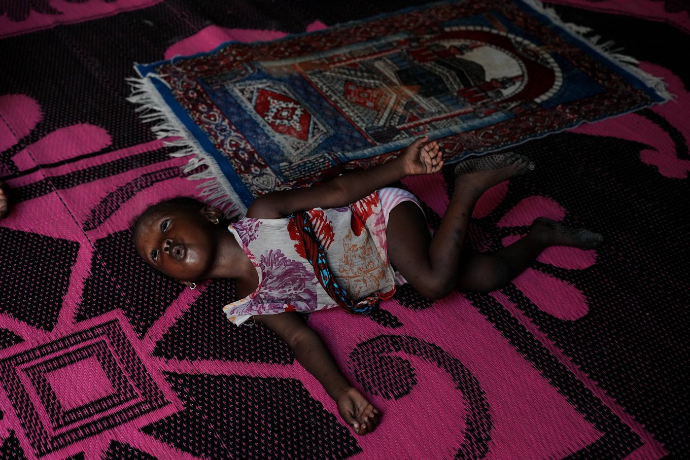 Nigerian children pay the price for the Iran war as malnutrition and poverty surge | iNFOnews.ca