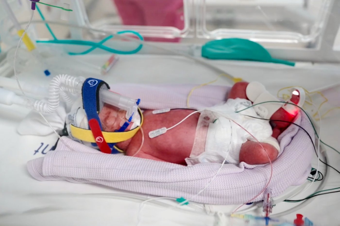 An Australian woman gives birth to rare identical quadruplet girls | iNFOnews.ca An Australian woman gives birth to rare identical quadruplet girls | iNFOnews.ca