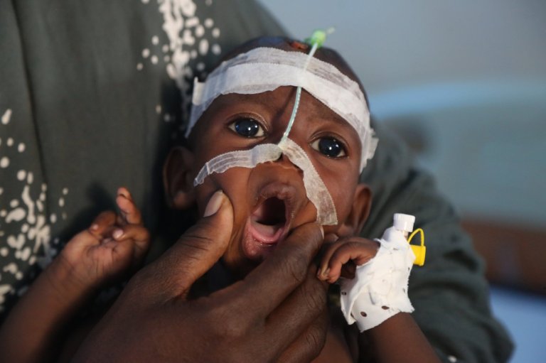 A visit to Somalia's crumbling hospitals shows the toll of aid cuts and war | iNFOnews.ca