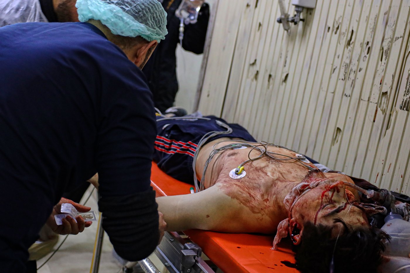 Photos of Syrians fleeing violence in Aleppo as shelling leaves heavy damage | iNFOnews.ca