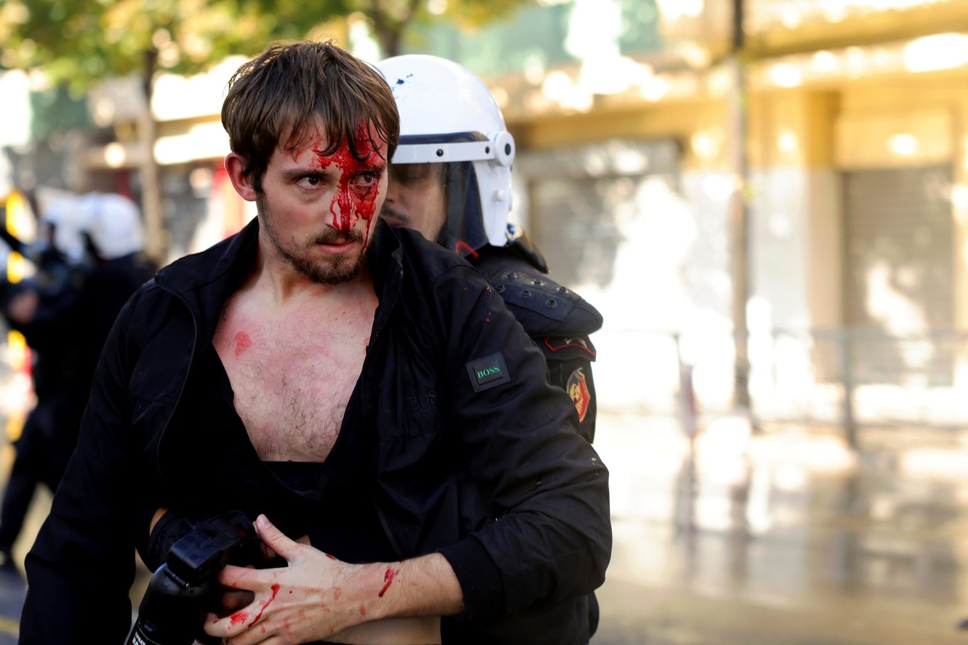 Clashes erupt in Albania as protesting students join anti-government movement | iNFOnews.ca