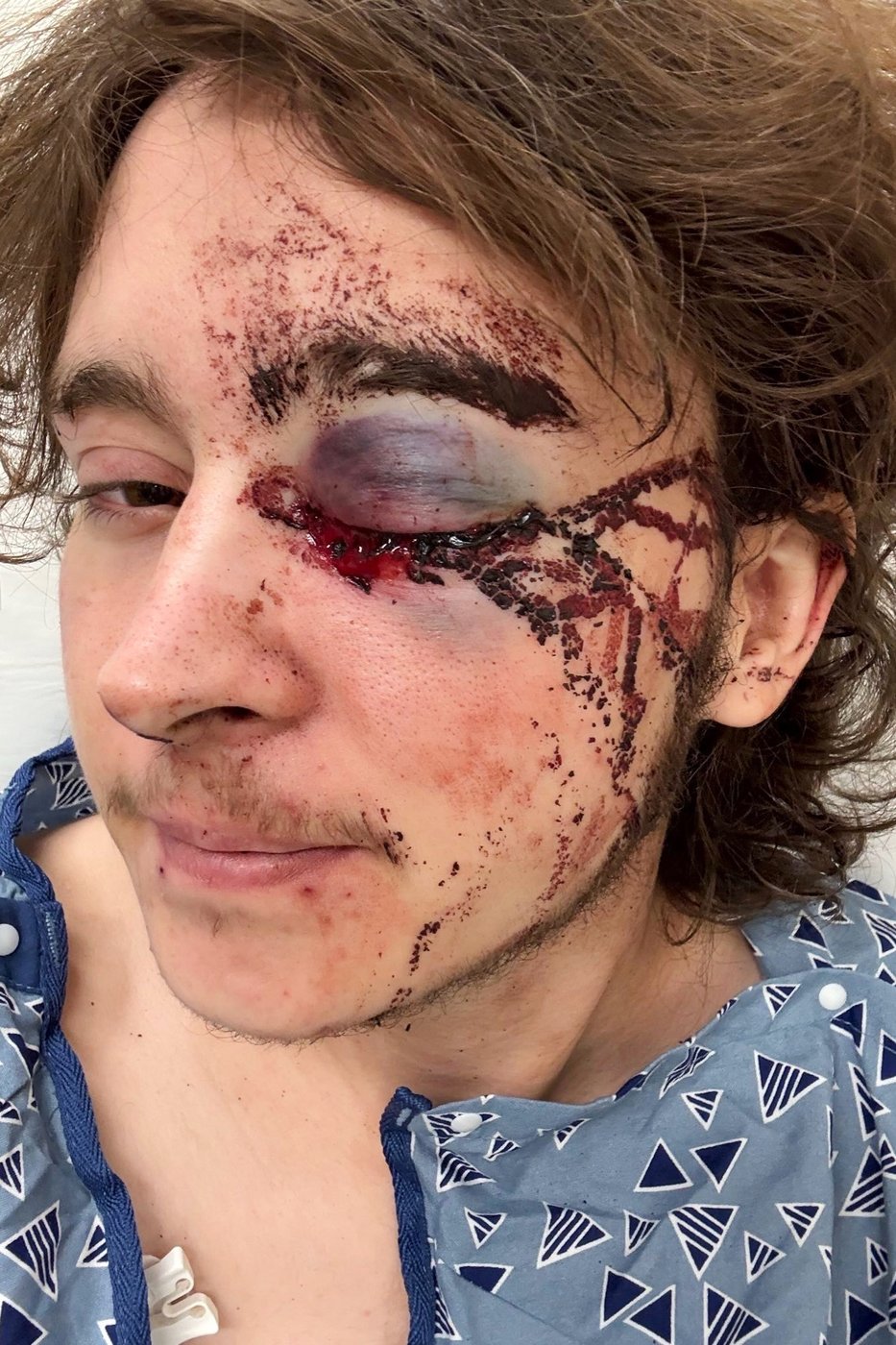 Demonstrator injured after federal agent fired projectile from close range during California protest | iNFOnews.ca