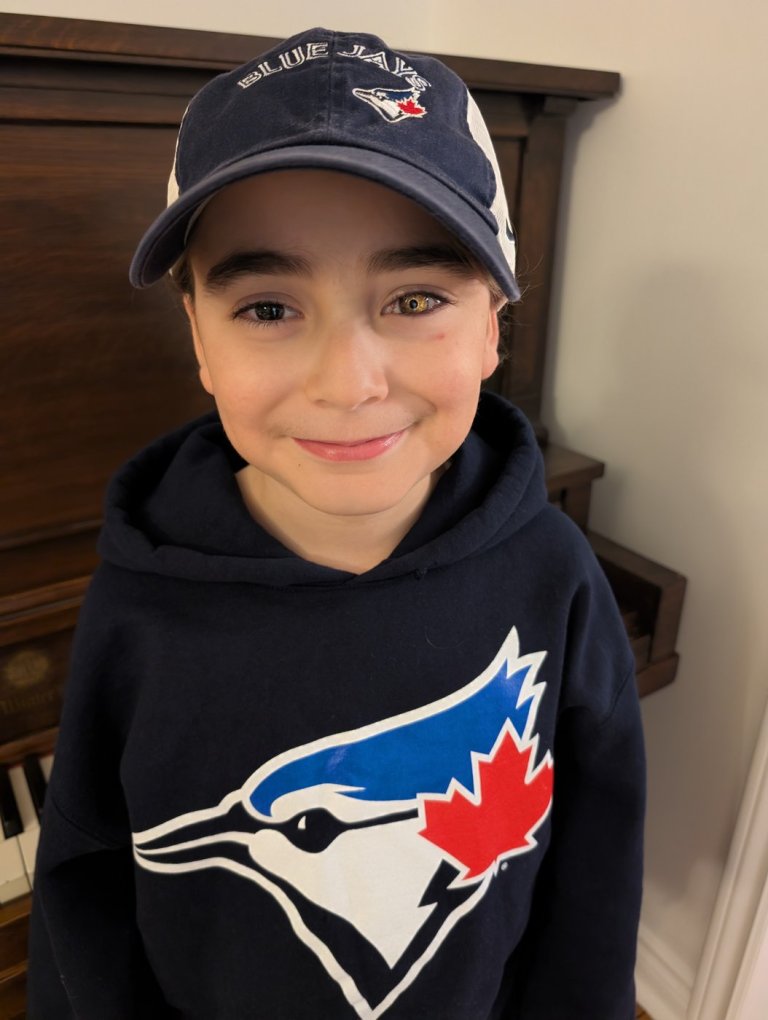 Eight-year-old shows his love for the Blue Jays with custom prosthetic eye | iNFOnews.ca