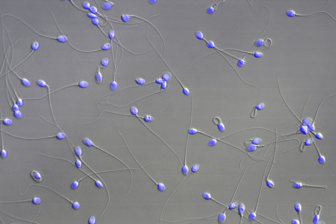 Scientists show how sperm and egg come together like a key in a lock | iNFOnews.ca Scientists show how sperm and egg come together like a key in a lock | iNFOnews.ca