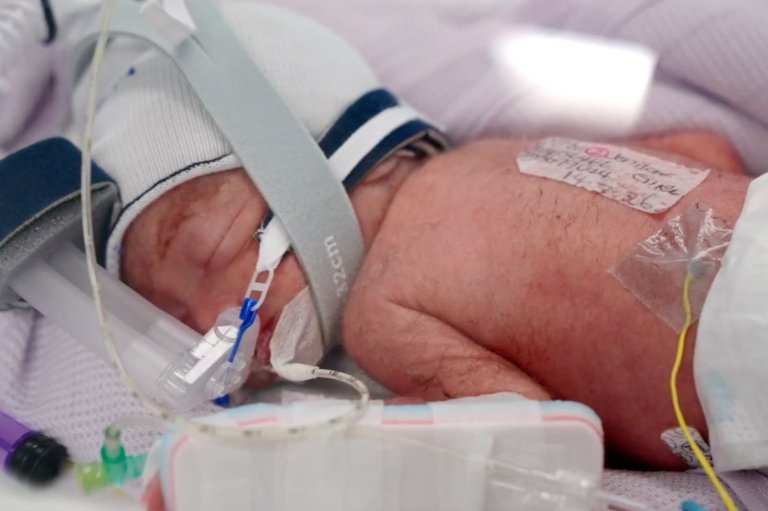 After an extremely rare pregnancy, an Australian woman gives birth to identical quadruplet girls | iNFOnews.ca