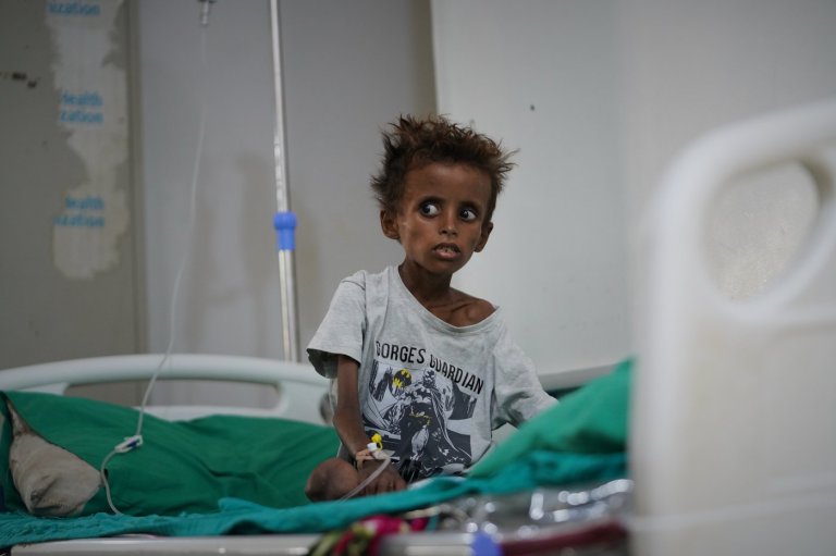 Yemen’s civil war returns and overwhelms hospitals with 'a very dangerous situation' | iNFOnews.ca