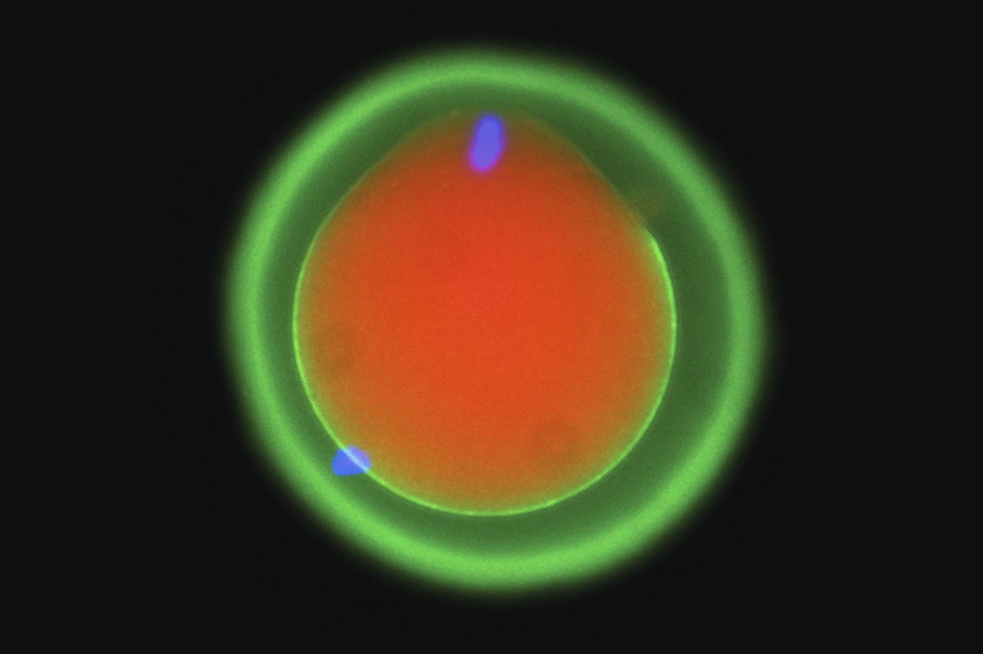 Scientists show how sperm and egg come together like a key in a lock | iNFOnews.ca Scientists show how sperm and egg come together like a key in a lock | iNFOnews.ca