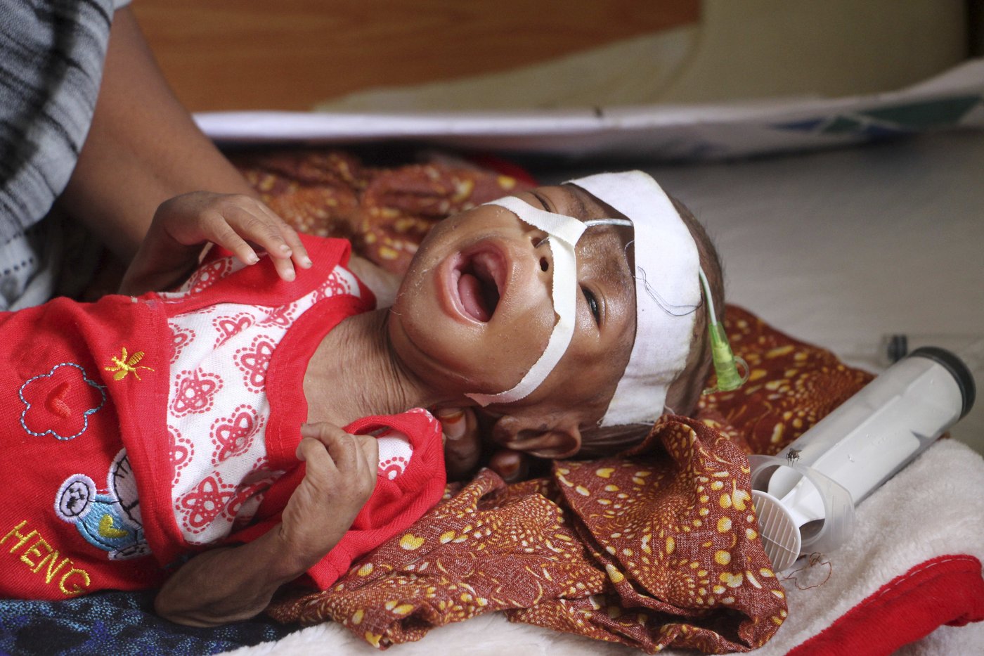 US aid kept many hungry Somali children alive. Now that money is disappearing | iNFOnews.ca