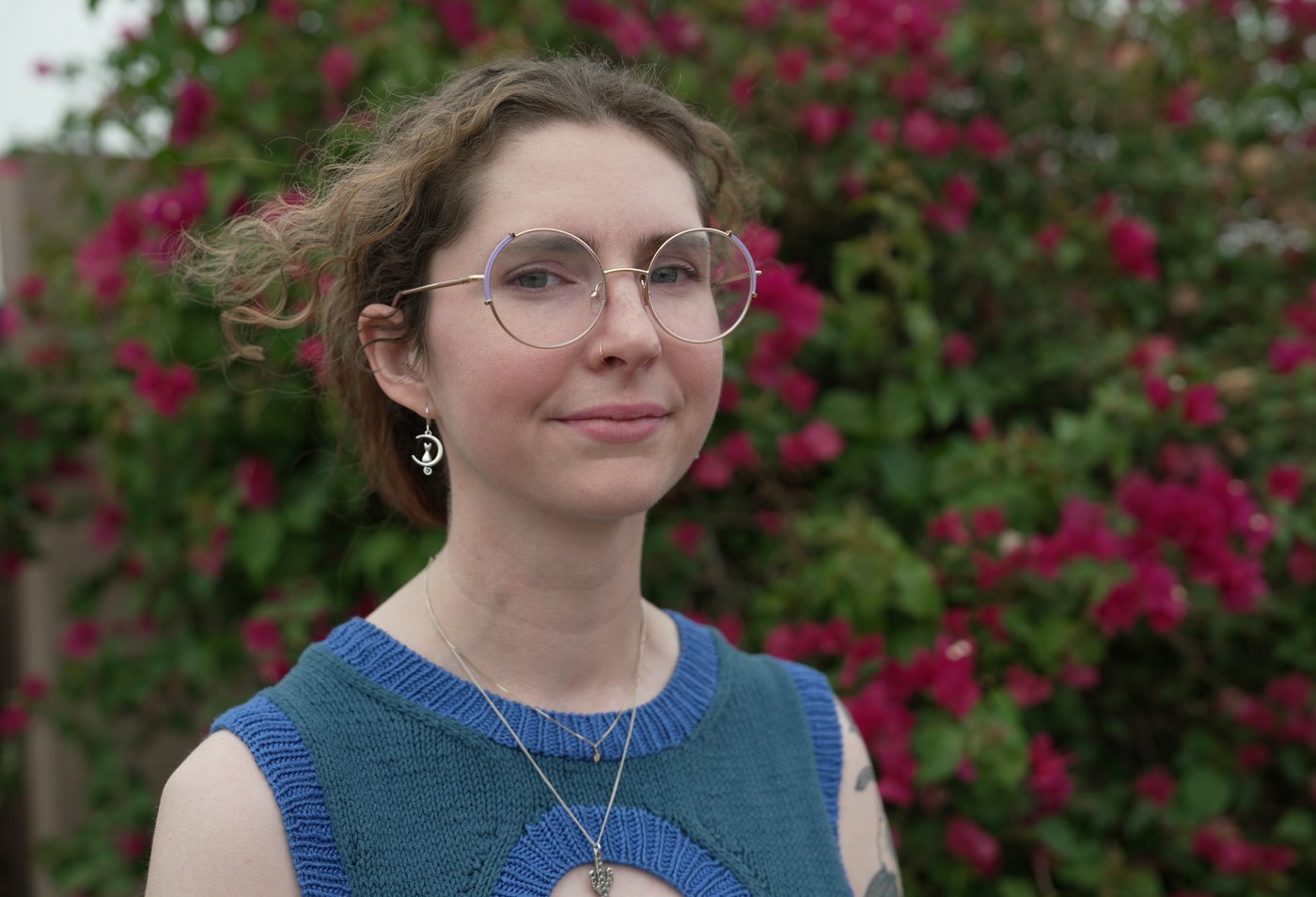 Arizona woman's 3-year wait for an intestine shows the US organ transplant system's complexity | iNFOnews.ca Arizona woman's 3-year wait for an intestine shows the US organ transplant system's complexity | iNFOnews.ca