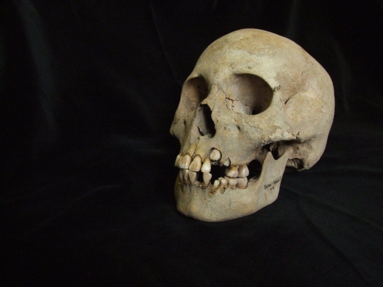 Ancient teeth from Siberia rewrite the plague’s timeline, dating back to over 5,500 years ago | iNFOnews.ca