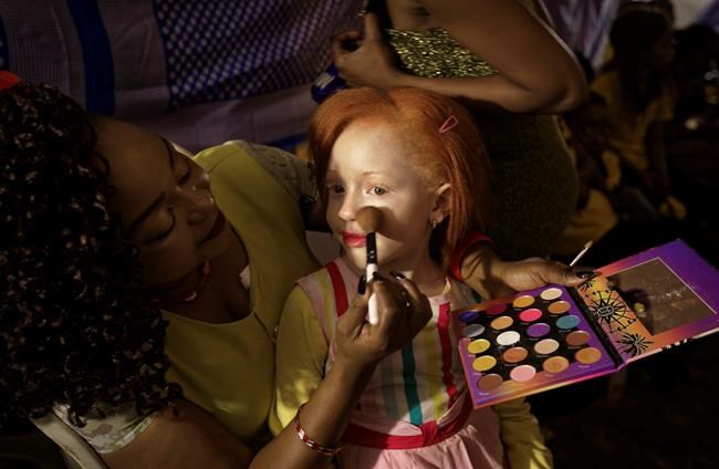 A groundbreaking beauty pageant for those with albinism | iNFOnews.ca