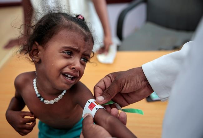 UN chief urges Yemen combatants to seize momentum for peace | iNFOnews.ca UN chief urges Yemen combatants to seize momentum for peace | iNFOnews.ca