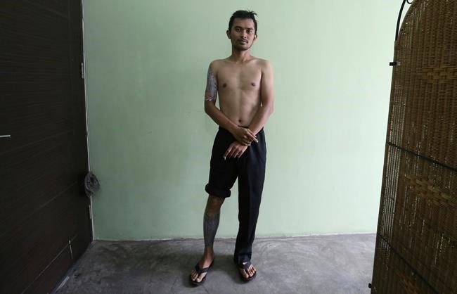 Indonesia clinic gives relief to Muslims with tattoo regrets | iNFOnews.ca