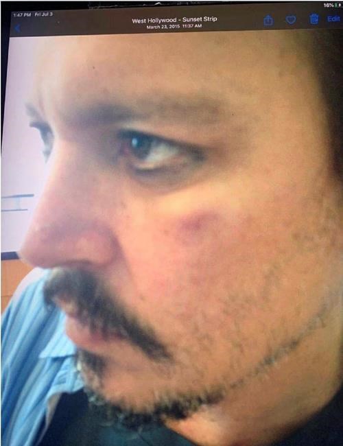 Depp's bodyguard says Amber Heard abused the Hollywood star | iNFOnews.ca