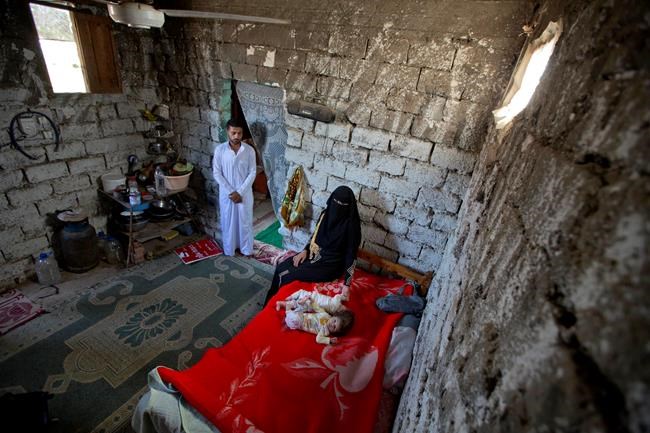 Egyptian family seeks help for conjoined twins | iNFOnews.ca