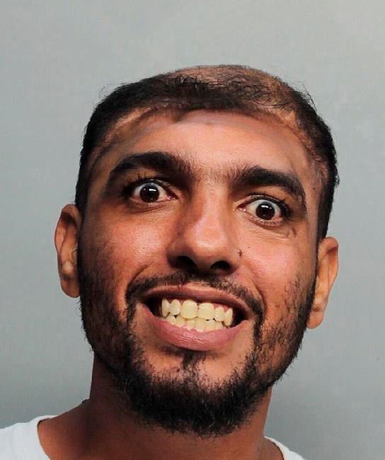 Man with deformed skull charged with arson, attempted murder | iNFOnews.ca Man with deformed skull charged with arson, attempted murder | iNFOnews.ca