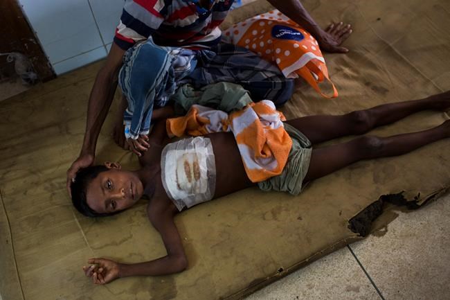 Bangladesh hospital struggles to cope with Rohingya wounds | iNFOnews.ca Bangladesh hospital struggles to cope with Rohingya wounds | iNFOnews.ca