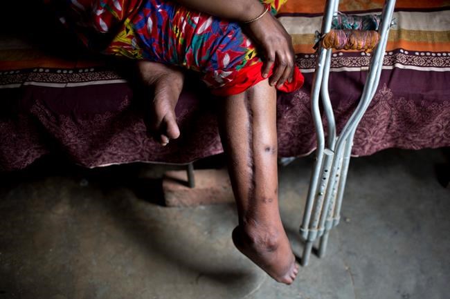 Bangladesh marks 5 years after garment factory collapse | iNFOnews.ca Bangladesh marks 5 years after garment factory collapse | iNFOnews.ca