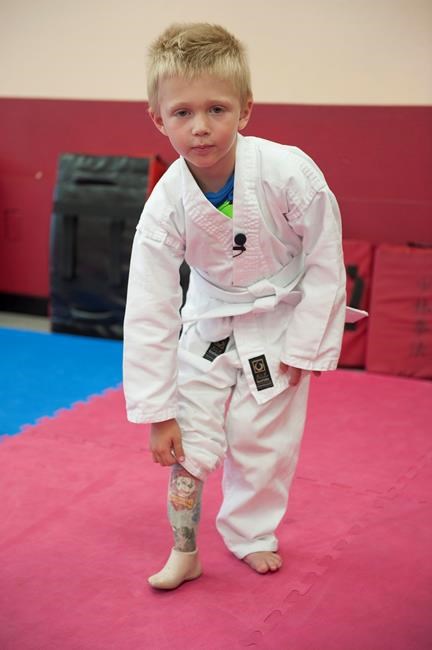 California boy to get new prosthetic leg after beach theft | iNFOnews.ca