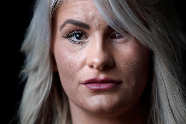 1 year after Vegas shooting, survivors describe 'new normal' | iNFOnews.ca 1 year after Vegas shooting, survivors describe 'new normal' | iNFOnews.ca