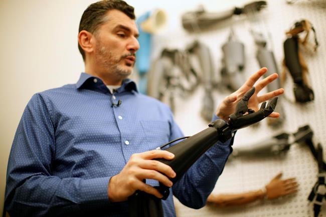 Grant extends reach of low cost 3D-printed hands, back braces to Canadian kids | iNFOnews.ca