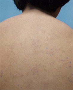 CP29127774