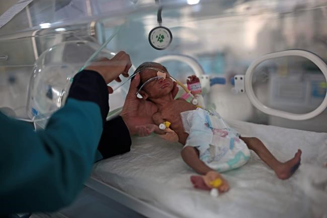 UN: Over 2 million Yemeni children may starve in 2021 | iNFOnews.ca