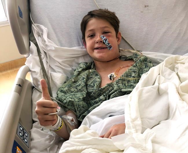 'Miraculous': Boy survives after meat skewer pierces skull | iNFOnews.ca