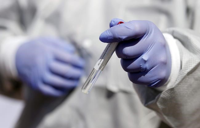 What you need to know today about the virus outbreak | iNFOnews.ca