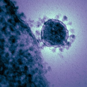 CP21315725