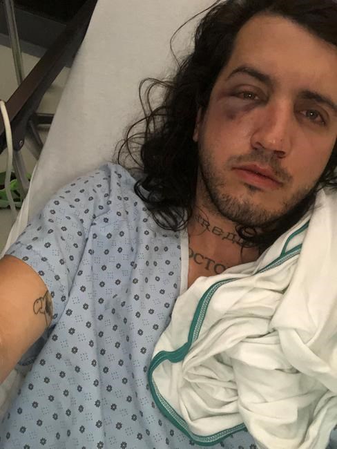Quebec designer and partner say they were victims of homophobic attack | iNFOnews.ca
