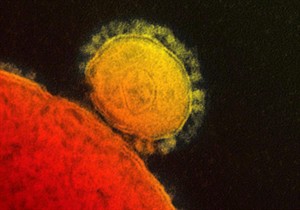 US MERS case spread disease to a contact; first onward spread in North America | iNFOnews.ca CP28406228